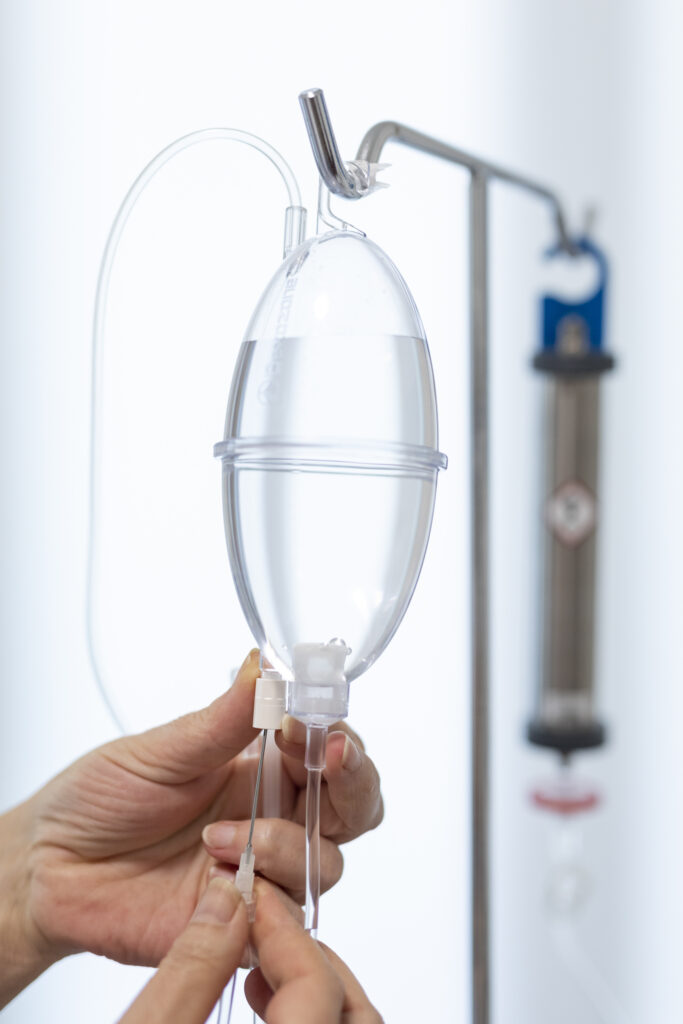 Ozonización de suero